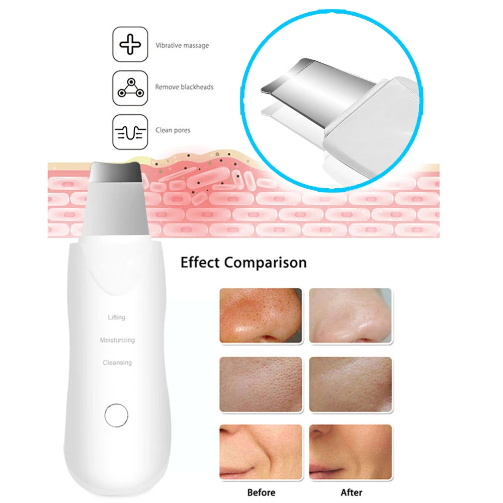 Ultrasonic Facial Skin Cleaner